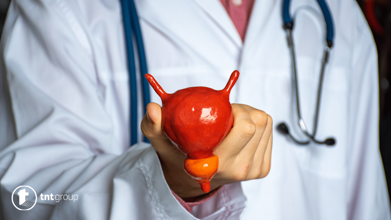 Benigna hiperplazija prostate